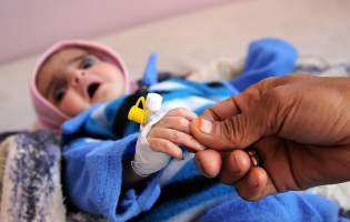 روزی 80 نوزاد در یمن به دلیل محاصره این کشور می‌میرند